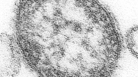 Measles virus particle seen under electron microscope