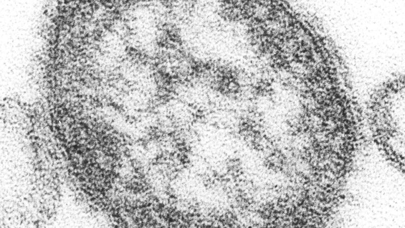 Measles virus particle seen under electron microscope