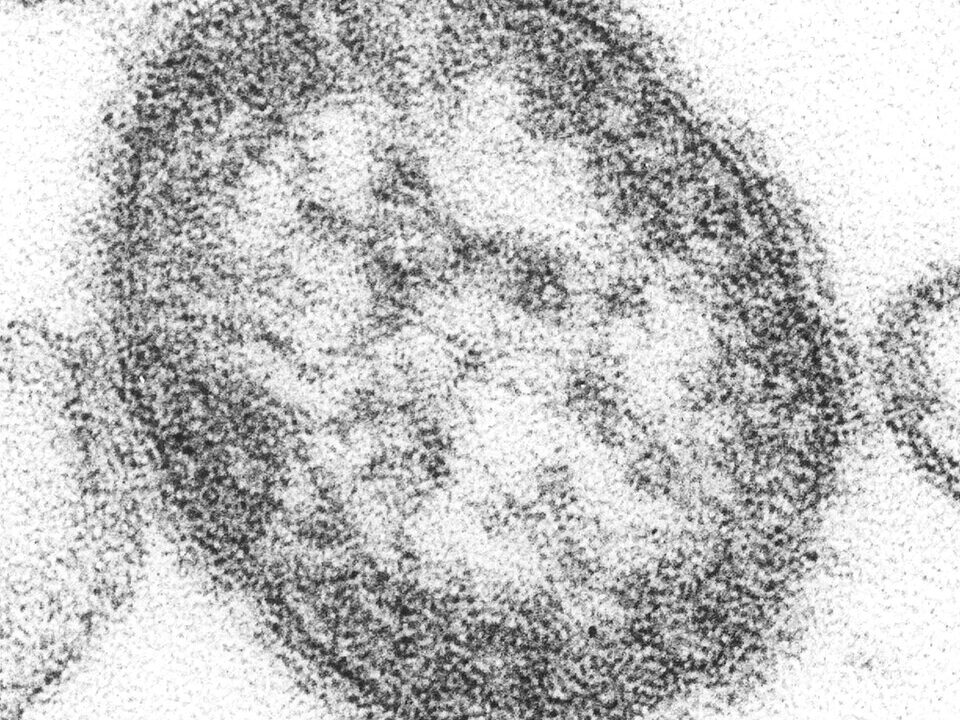 Measles virus particle seen under electron microscope